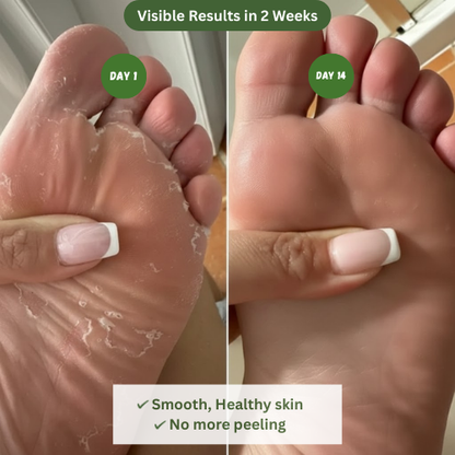 VASINEA Anti-Fungal Soap